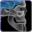 Temporomandibular Joint Disorder (TMD)